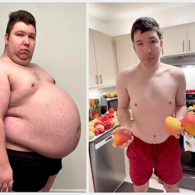 Potret Nikocado Avocado, Bintang Mukbang yang Pangling Usai Turun 113 Kg!