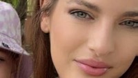 Impian Mirip Kylie Jenner Berujung Koma, Kisah Pilu Wanita yang Oplasnya Gagal