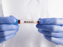 Ratusan Warga di AS Dikarantina usai Terinfeksi Virus Menular Ini