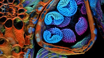 Dr. Igor Siwanowicz Spora (struktur biru/ungu) dari pakis tropis kecil ( Ceratopteris richardii ) Foto: Nikon Small World