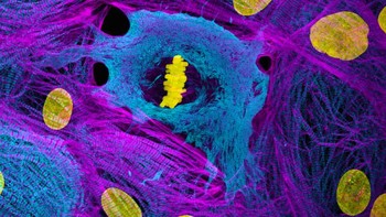 Dr. Dylan Burnette mengabadikan Sel otot jantung (berasal dari iPSC) menunjukkan kromosom yang terkondensasi pada fase metafase Foto: Nikon Small World
