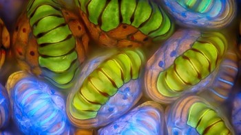 Ini Kantong spora ( sporangia ) dari tumbuhan paku karya Rogelio Moreno ( Foto: Nikon Small World