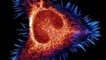 Karya Halli Lindamood menampilkan Sitoskeleton aktin (sian) dan retikulum endoplasma (merah) dari sel kanker otak tikus Foto: Nikon Small World