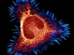 Foto Dunia Mikro Ini Nyata, Bukan Editan Photoshop!