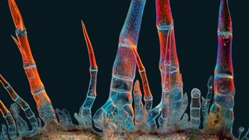 Menampilkan Marek Mis menampilkan Trikoma bunga matahari (tonjolan tanaman seperti rambut)Foto: Nikon Small World