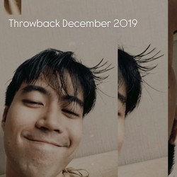 Senyum Vidi Aldiano Gak Pudar di Tengah Sakit Kanker