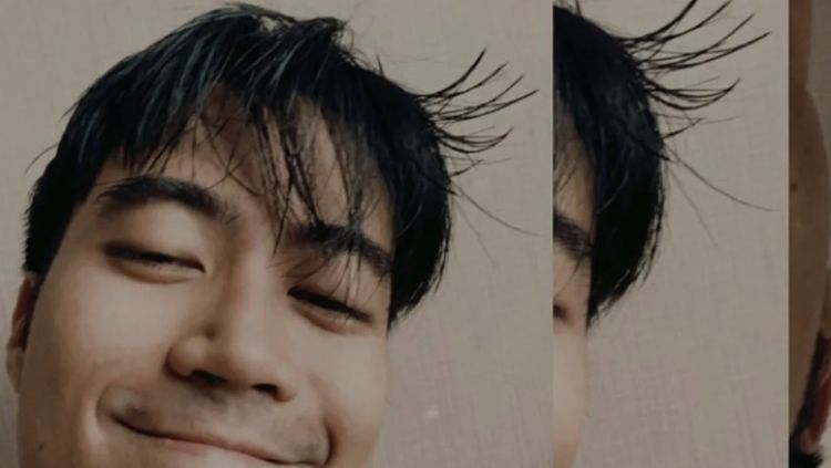 Senyum Vidi Aldiano Gak Pudar di Tengah Sakit Kanker