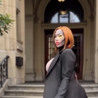 Dalam unggahan emosional pada 2023, ia mengaku terjebak dalam lingkaran tanpa akhir untuk memperbaiki operasi yang gagal. “Ini bukan lagi petualangan kecil yang menyenangkan. Ini melelahkan dalam segala hal,” tulisnya. Foto: dok. Instagram @marymagdalenedied