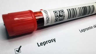 Kronologi WNI di Rumania Terkena Kusta, Jadi Kasus Pertama usai 44 Tahun