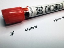 2 WNI di Rumania Kena Kusta, Komisi IX DPR Minta Tes Kesehatan PMI Diperketat