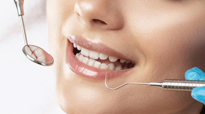 Pasang Aligner Vs Behel, Mana yang Lebih Cepat Rapikan Gigi?