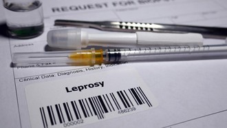 WNI Jadi Kasus Pertama Kusta di Rumania setelah 44 Tahun, Keluhkan Gejala Ini