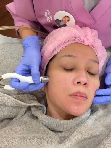 Hollywood Silkpeel di Airin Skin Clinic