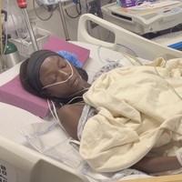 Supermodel Anok Yai Ungkap Penyakit Serius, Jalani Operasi Paru Robotik