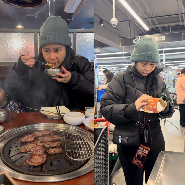 Denise Chariesta Operasi Plastik di Korea, Masih Sempat Kulineran!