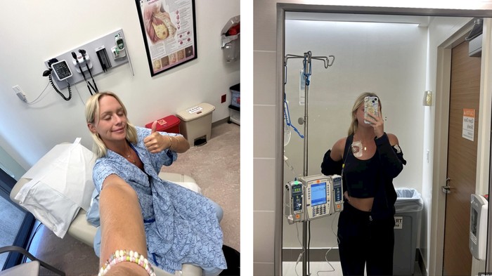 Cerita Gen Z Idap Kanker Payudara di Usia 24, Sudah Menopause di Umur 25