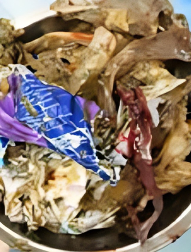Duh! Dokter Temukan 1 Kg Sampah Plastik di Perut Pasien, Ini Penampakannya