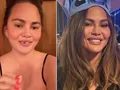 Waduh! Gigi Chrissy Teigen Copot Usai Gigit Permen Tongkat