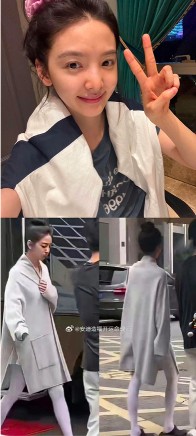 Bahkan untuk baju-baju syuting, Zhang Ruonan dilaporkan hanya bisa muat pakaian anak-anak ukuran 12 tahun. Saat memakai dress, ia juga membutuhkan 7-8 klip di pinggang agar terlihat tidak kebesaran. Foto: Weibo