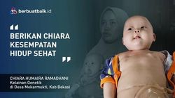 Dikepung Tumor Teratoma Immature, Balita Chiara Ingin Sembuh dan Sehat