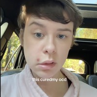 Cerita Wanita yang Kapok Pencet Jerawat, Wajahnya Tiba-tiba Lumpuh