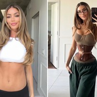 Tren Ozempic Body Makin Ekstrem, Kini Beralih ke Pengangkatan Tulang Rusuk