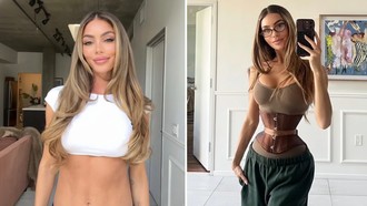 Tren 'Ozempic Body' Makin Ekstrem, Kini Beralih ke Pengangkatan Tulang Rusuk