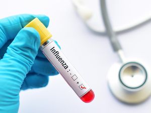 Dokter Ungkap Cara Cegah Penularan Influenza yang Makin Marak di Surabaya