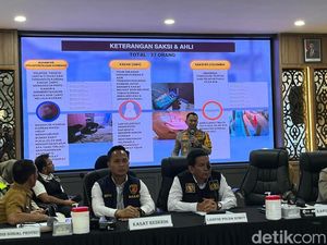Polisi: Ibu Dibunuh Siswi SD di Medan Alami 26 Luka Tusuk