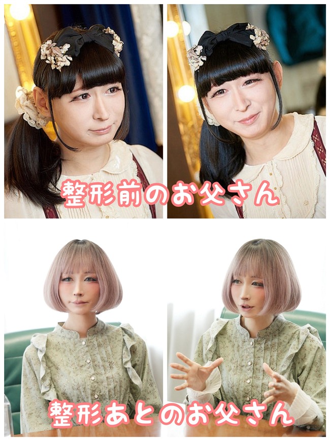 Selain itu, Takuma secara terbuka mengaku bahwa ia memang melakukan operasi plastik untuk melengkapi penampilan cantiknya. Foto: Twitter