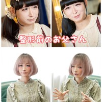 Selain itu, Takuma secara terbuka mengaku bahwa ia memang melakukan operasi plastik untuk melengkapi penampilan cantiknya. Foto: Twitter