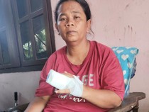 Awal Mula Jari Tangan Wanita Gresik Patah Dianiaya Debt Collector