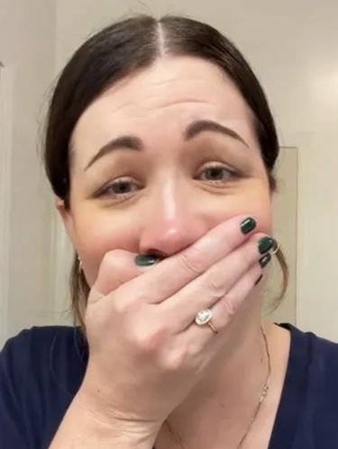 Wanita ini kaget dengan efek botoxnya