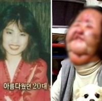 Kisah Aktris Korea yang Wajahnya Hancur karena Oplas, Kini Jadi Begini