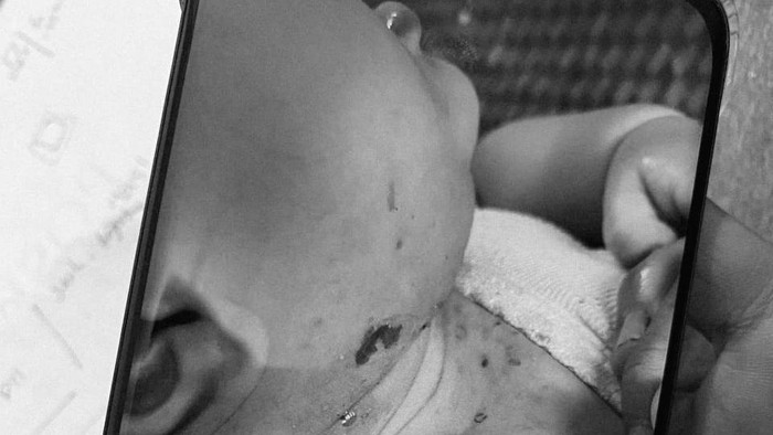 Polisi Tempuh Perjalanan 14 Jam Usai Ada Info Bayi Sakit Pascabencana Aceh Tengah