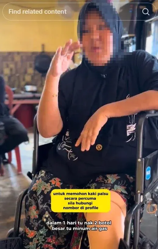 Dua Kaki Pria Ini Harus Diamputasi Akibat Sering Minum Soda Manis Dua Kaki Pria Ini Harus Diamputasi Akibat Sering Minum Soda Manis