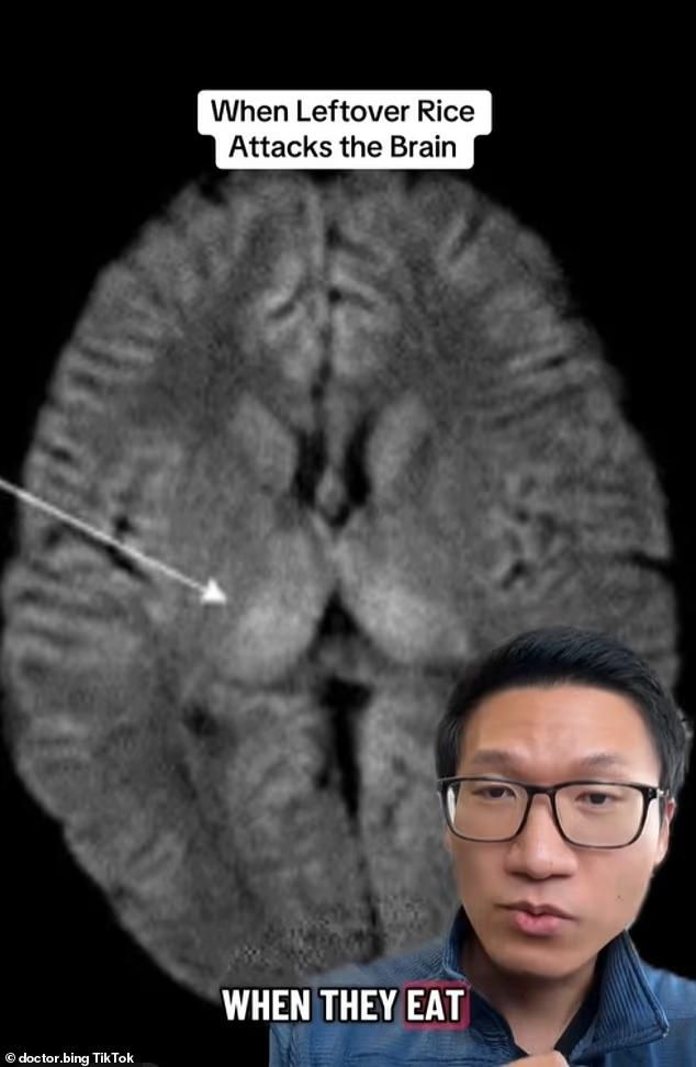 Jangan Sembarangan Makan Nasi Sisa, Dokter Ungkap Risiko Fatal!