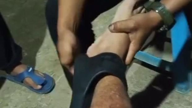 Sandal nyangkut di betis, pria di Pandeglang pilih datangi Damkar