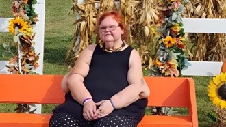 Cerita Diet Wanita Sukses Pangkas 226 Kg, Perubahannya Jadi Sorotan