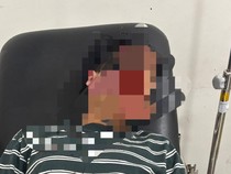 Pegawai Bank di Lampung Dianiaya Anak Purnawirawan Polri, Kepala Korban Luka