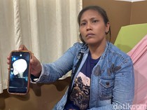 Balita Korban Peluru Nyasar di Belawan Selesai Jalani Operasi, Begini Kondisinya