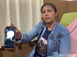 Mata Balita Tertembak Saat Ada Tawuran di Medan Belawan
