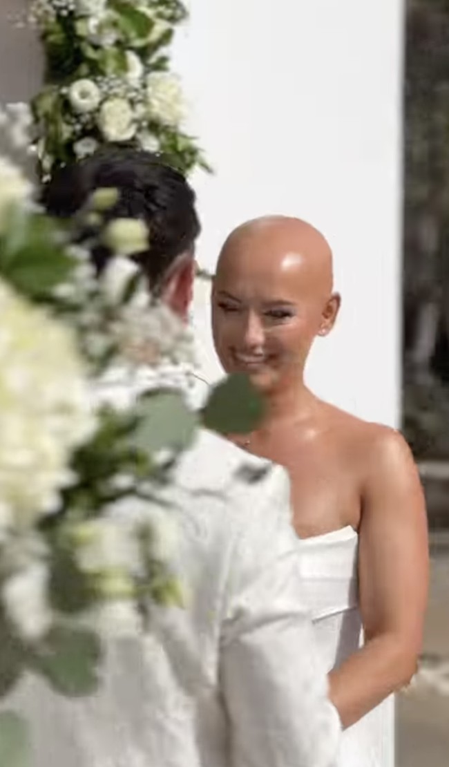 Pengantin wanita jadi viral setelah tampil botak di hari pernikahannya. Wanita bernama Dani didiagnosis mengidap alopecia universalis, yang menyebabkan kerontokan rambut dan bulu di seluruh tubuh, sejak usia dua tahun. Sejak remaja, ia telah kehilangan semua rambut di kepalanya.  Foto: dok. Instagram