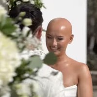 Pengantin wanita jadi viral setelah tampil botak di hari pernikahannya. Wanita bernama Dani didiagnosis mengidap alopecia universalis, yang menyebabkan kerontokan rambut dan bulu di seluruh tubuh, sejak usia dua tahun. Sejak remaja, ia telah kehilangan semua rambut di kepalanya.  Foto: dok. Instagram