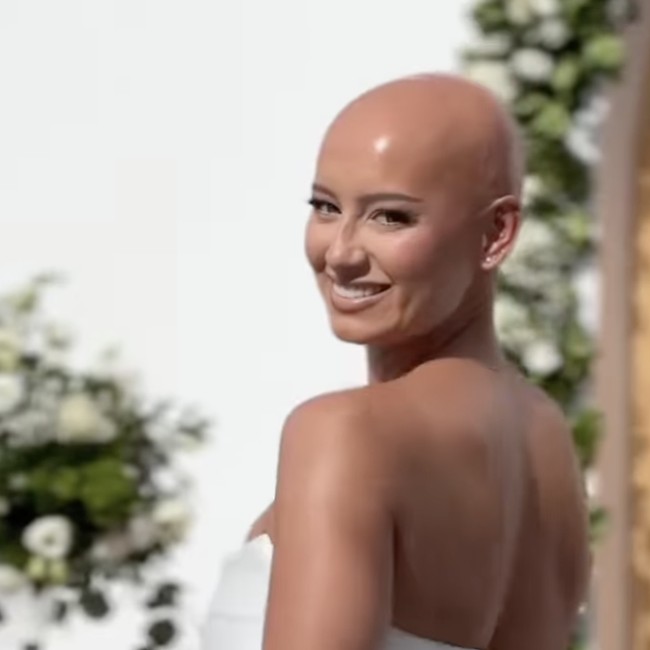 Potret Menyentuh Pengantin Wanita yang Tampil Botak di Hari Pernikahan