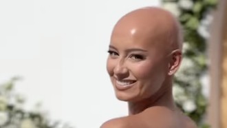 Potret Menyentuh Pengantin Wanita yang Tampil Botak di Hari Pernikahan