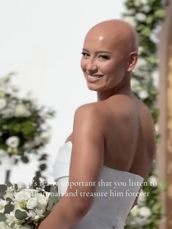 Potret Menyentuh Pengantin Wanita yang Tampil Botak di Hari Pernikahan