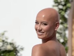 Potret Menyentuh Pengantin Wanita yang Tampil Botak di Hari Pernikahan