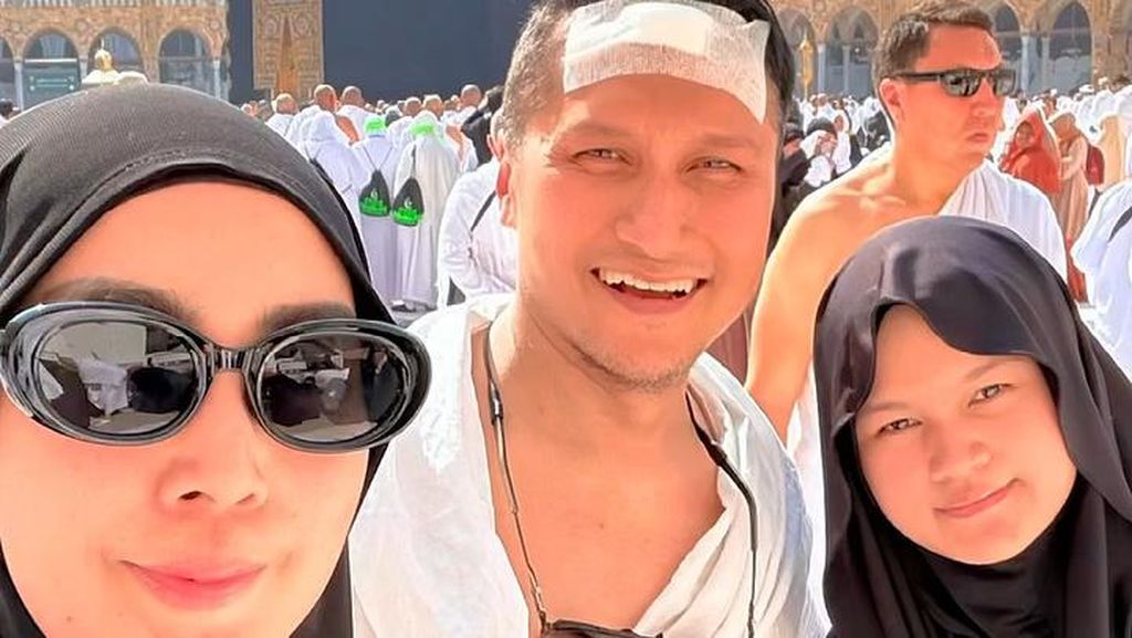 Arie Untung Alami Kepala Bocor di Arab