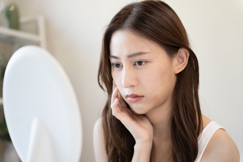 Young woman asian are worried about faces Dermatology and allergic to steroids in cosmetics. sensitive skin, red face from sunburn, acne, allergic to chemicals, rash on face. skin problems and beauty